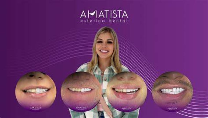 Amatista Estetica Dental Veneer / Cancun Vlog YouTube