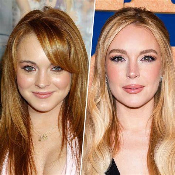 Lindsay Lohan from Celebs Who Deny Getting Plastic Surgery